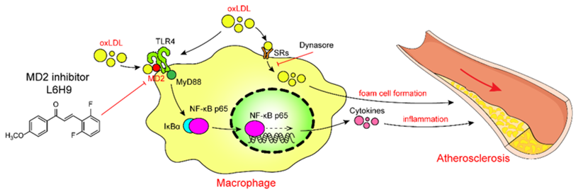 巨噬细胞源的MD2在ox-LDL引起的慢性炎症和动脉粥样硬化中起关键作用